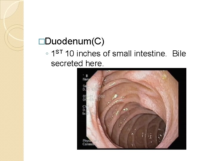 �Duodenum(C) ◦ 1 ST 10 inches of small intestine. Bile secreted here. 