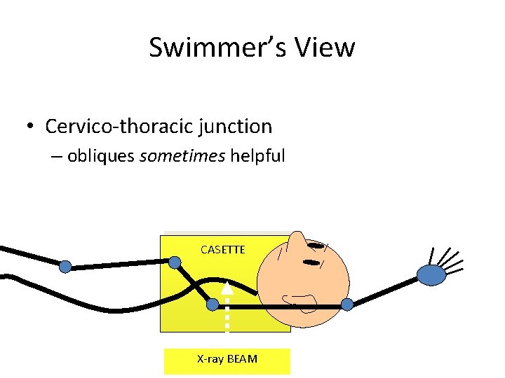 Swimmer’s View • Cervico-thoracic junction – obliques sometimes helpful CASETTE X-ray BEAM 