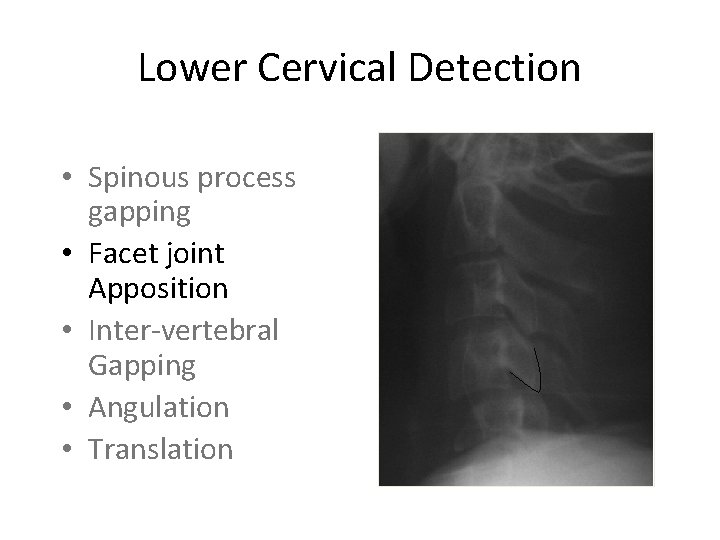 Lower Cervical Detection • Spinous process gapping • Facet joint Apposition • Inter-vertebral Gapping