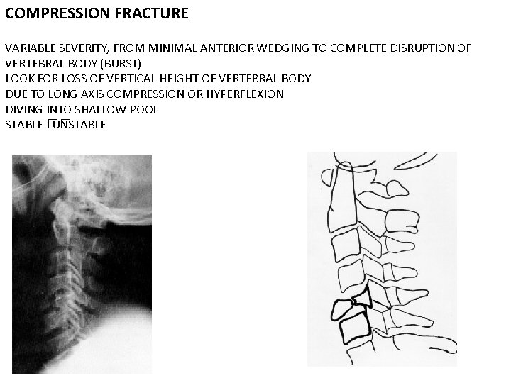 COMPRESSION FRACTURE VARIABLE SEVERITY, FROM MINIMAL ANTERIOR WEDGING TO COMPLETE DISRUPTION OF VERTEBRAL BODY