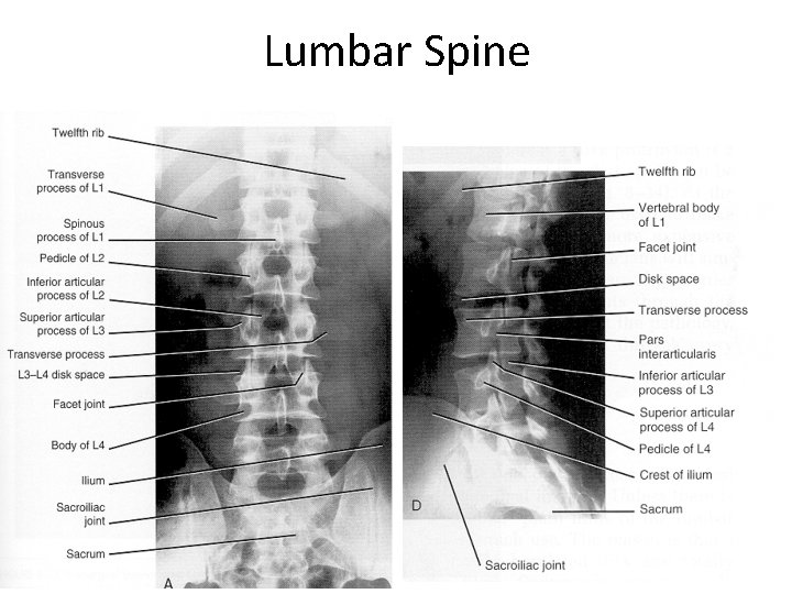 Lumbar Spine 