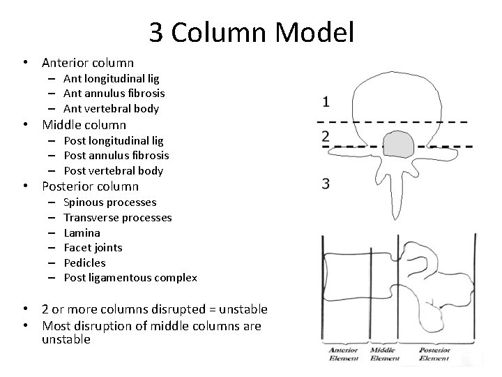 3 Column Model • Anterior column – Ant longitudinal lig – Ant annulus fibrosis