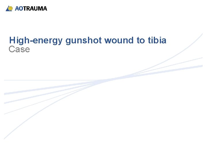 High-energy gunshot wound to tibia Case 