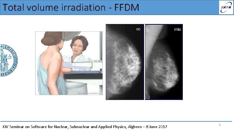 Total volume irradiation - FFDM XIV Seminar on Software for Nuclear, Subnuclear and Applied