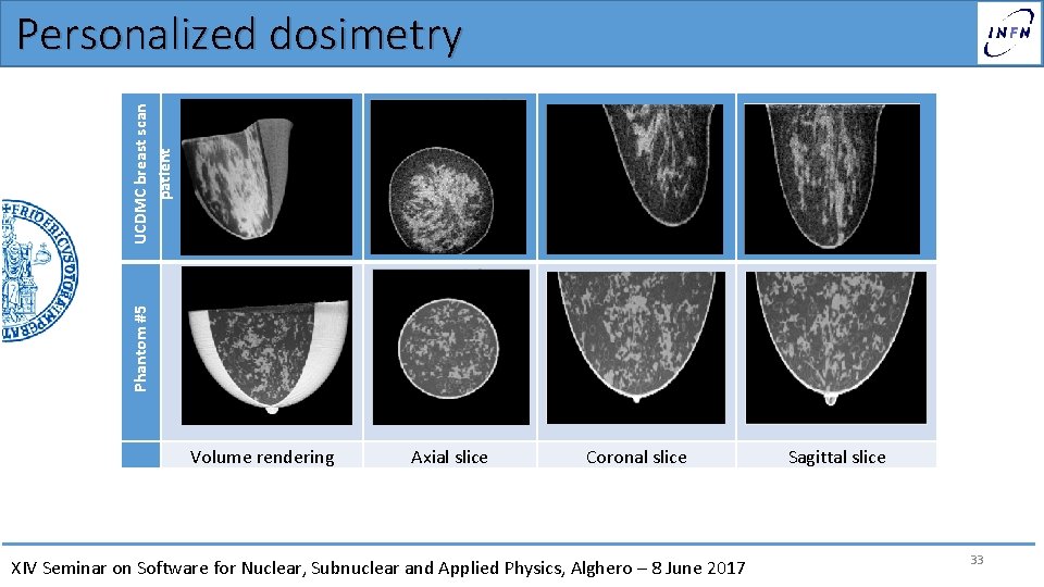 Phantom #5 UCDMC breast scan patient Personalized dosimetry Volume rendering Axial slice Coronal slice