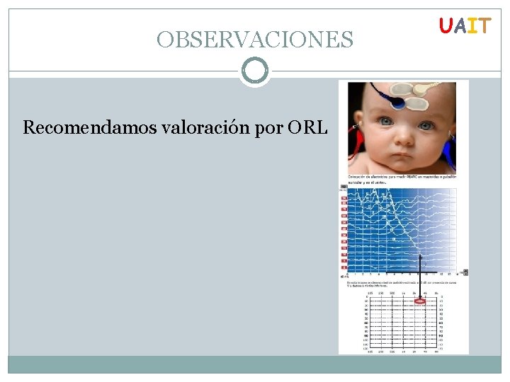 OBSERVACIONES Recomendamos valoración por ORL UAIT 