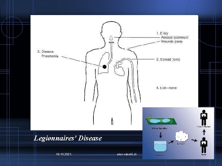 Legionnaires' Disease 19. 10. 2021. alen vukelić, dr 