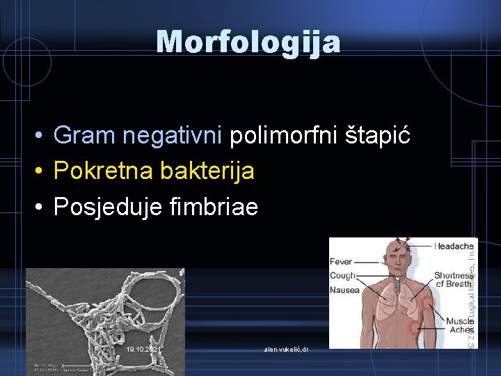 Morfologija • Gram negativni polimorfni štapić • Pokretna bakterija • Posjeduje fimbriae 19. 10.
