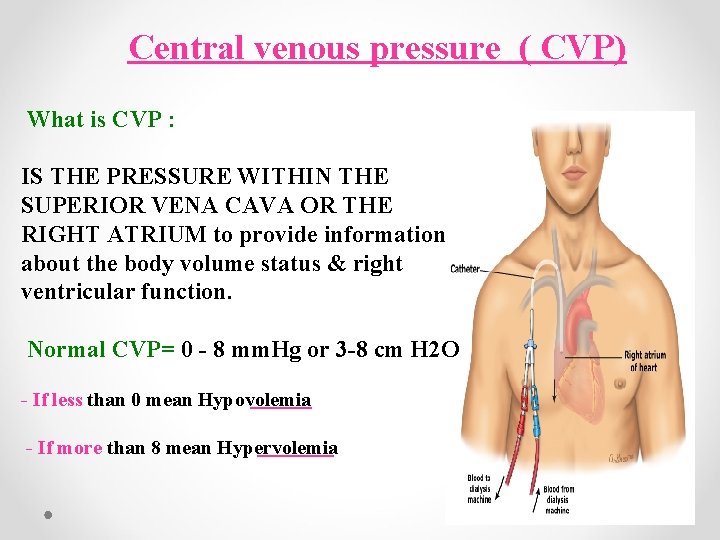 Central venous pressure ( CVP) What is CVP : IS THE PRESSURE WITHIN THE