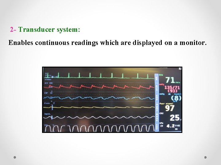 2 - Transducer system: Enables continuous readings which are displayed on a monitor. 