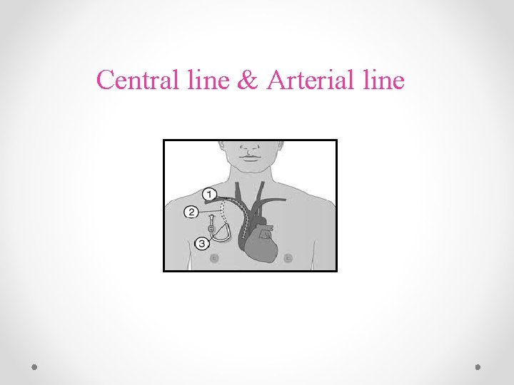 Central line & Arterial line 