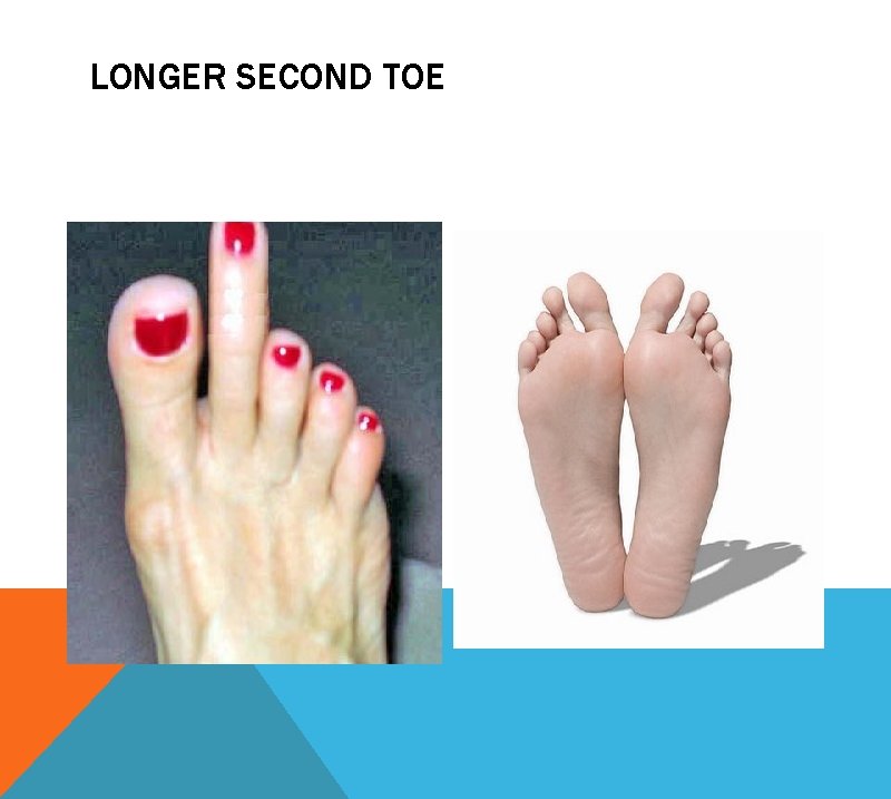 LONGER SECOND TOE 