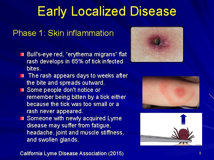 Lyme Disease Emergence of a Borreliosis Pandemic Patricia
