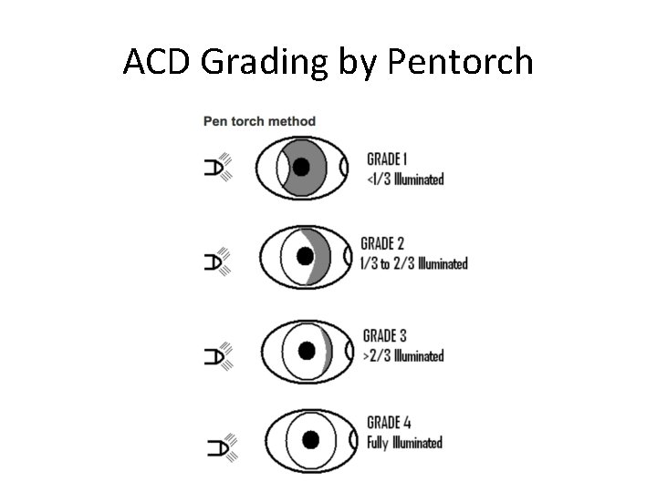 ACD Grading by Pentorch 