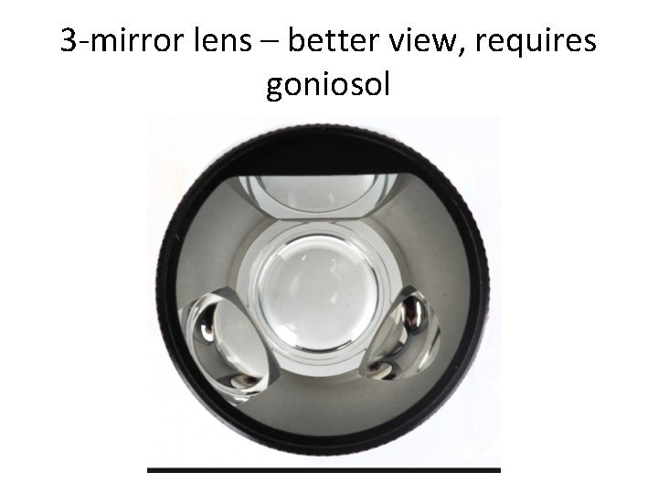 3 -mirror lens – better view, requires goniosol 