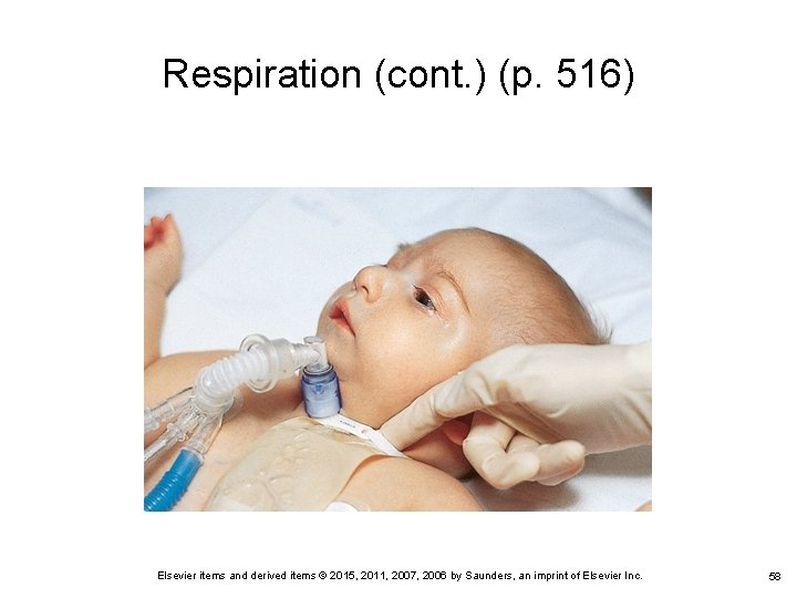 Respiration (cont. ) (p. 516) Elsevier items and derived items © 2015, 2011, 2007, Respiration (cont. ) (p. 516) Elsevier items and derived items © 2015, 2011, 2007,