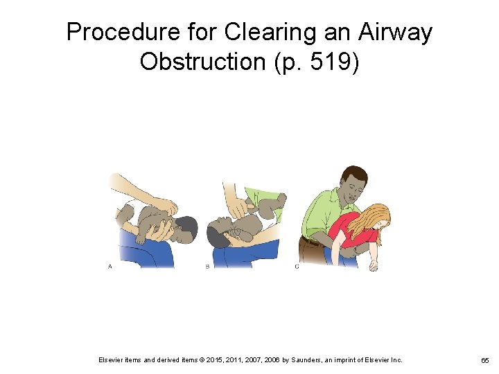 Procedure for Clearing an Airway Obstruction (p. 519) Elsevier items and derived items © Procedure for Clearing an Airway Obstruction (p. 519) Elsevier items and derived items ©