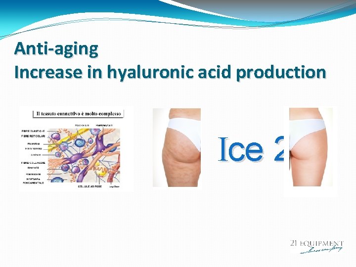 Anti-aging Increase in hyaluronic acid production Ice 21 