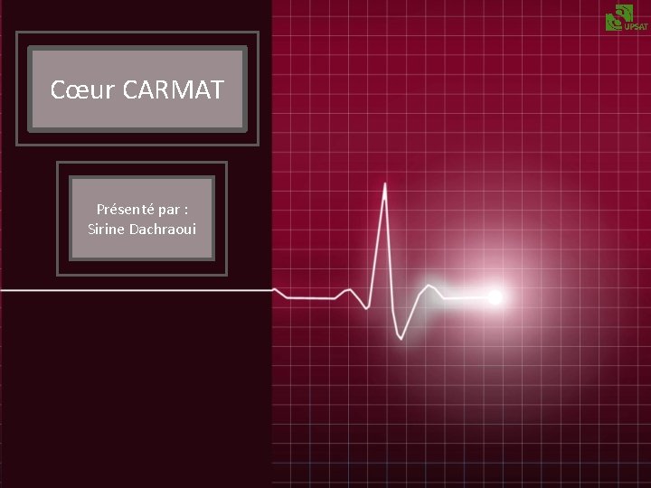 Cœur CARMAT Présenté par : Sirine Dachraoui 