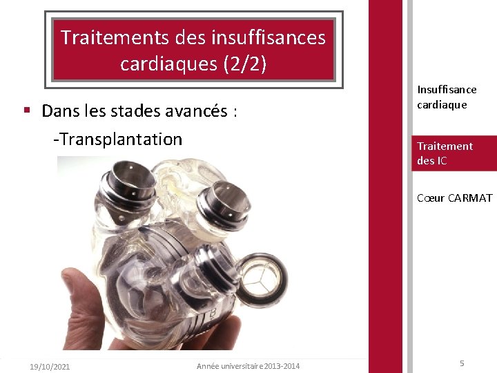 Traitements des insuffisances cardiaques (2/2) § Dans les stades avancés : -Transplantation Insuffisance cardiaque