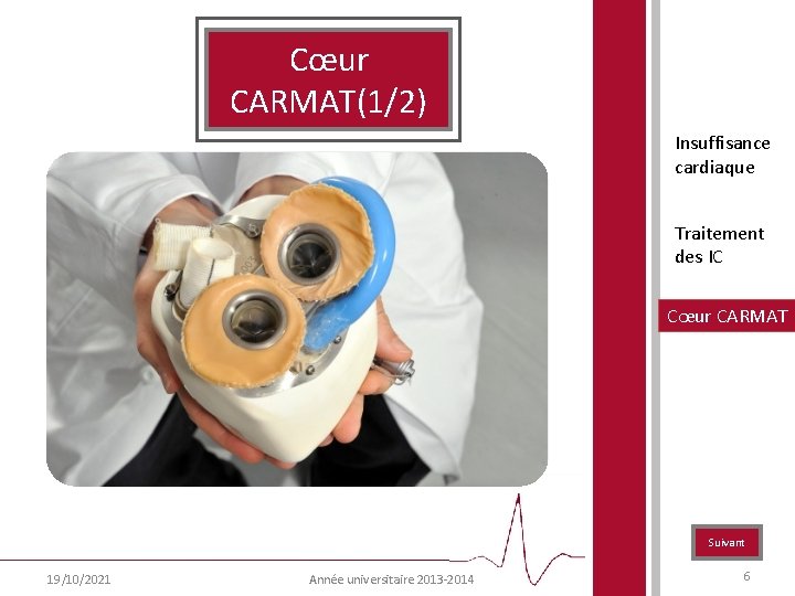 Cœur CARMAT(1/2) Insuffisance cardiaque Traitement des IC Cœur CARMAT Suivant 19/10/2021 Année universitaire 2013