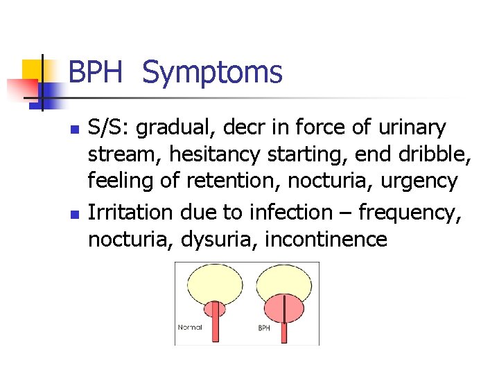 BPH Symptoms n n S/S: gradual, decr in force of urinary stream, hesitancy starting,