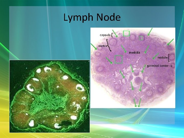 Lymph Node 