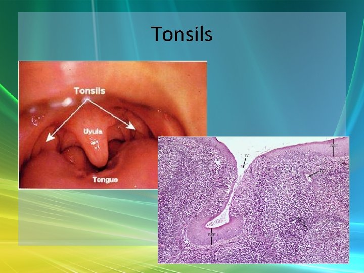 Tonsils 