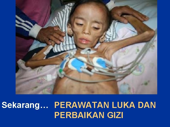 Sekarang… PERAWATAN LUKA DAN PERBAIKAN GIZI 