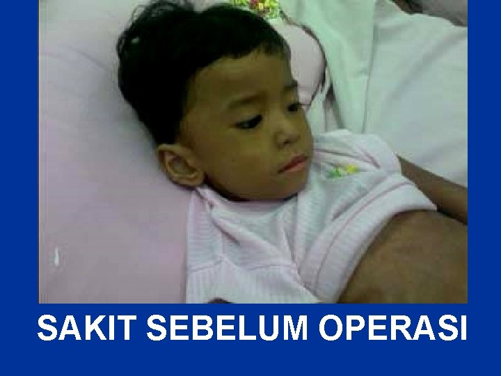 SAKIT SEBELUM OPERASI 