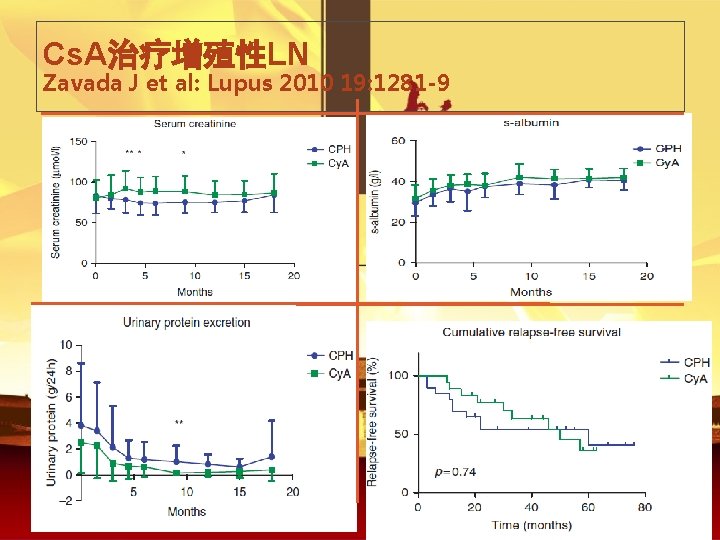 Cs. A治疗增殖性LN Zavada J et al: Lupus 2010 19: 1281 -9 