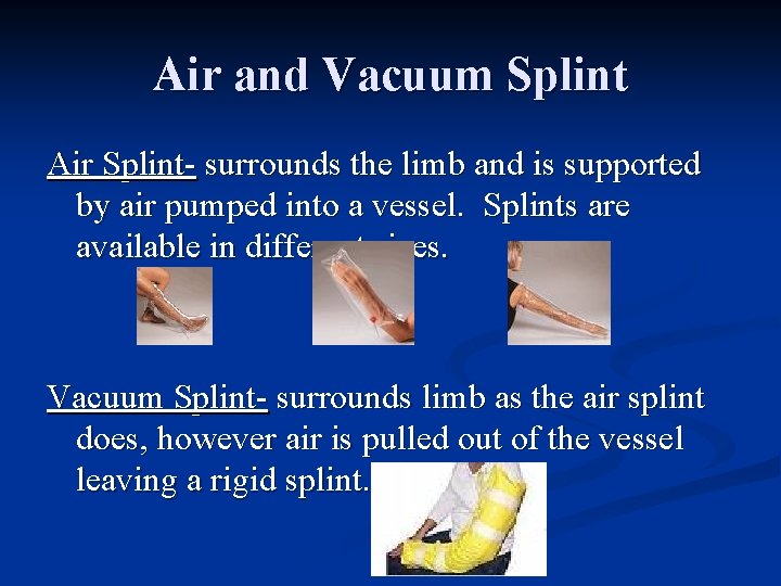 Air and Vacuum Splint Air Splint- surrounds the limb and is supported by air