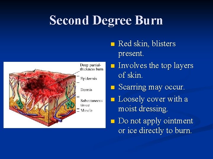 Second Degree Burn n n Red skin, blisters present. Involves the top layers of