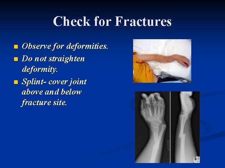 Check for Fractures n n n Observe for deformities. Do not straighten deformity. Splint-