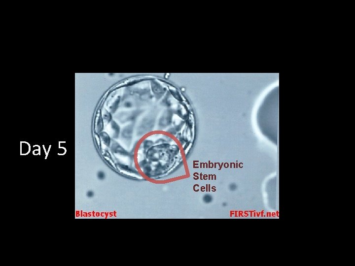 Day 5 Embryonic Stem Cells 