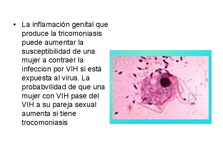  • La inflamación genital que produce la tricomoniasis puede aumentar la susceptibilidad de