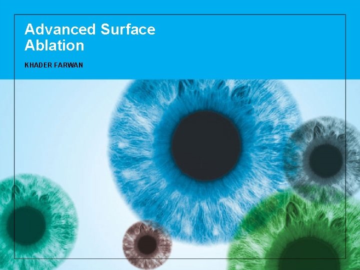 Advanced Surface Ablation KHADER FARWAN 