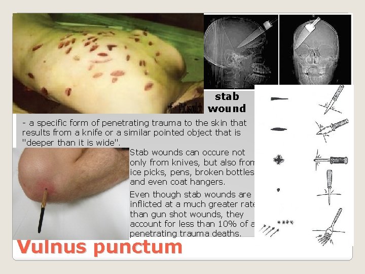 stab wound - a specific form of penetrating trauma to the skin that results