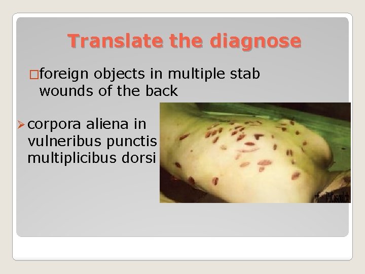 Translate the diagnose �foreign objects in multiple stab wounds of the back Ø corpora