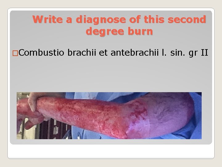 Write a diagnose of this second degree burn �Combustio brachii et antebrachii l. sin.