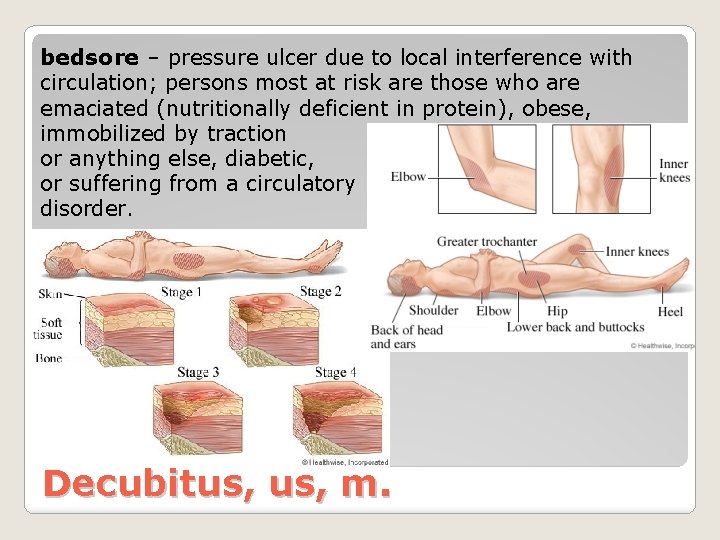 bedsore – pressure ulcer due to local interference with circulation; persons most at risk