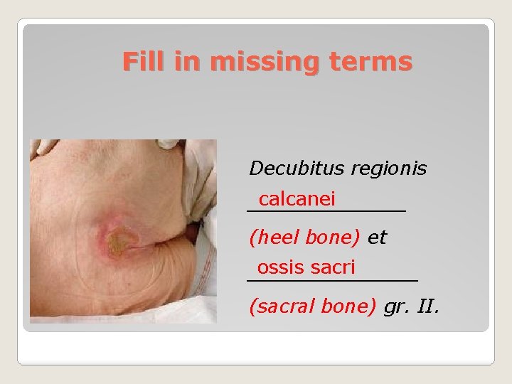 Fill in missing terms Decubitus regionis calcanei _______ (heel bone) et ossis sacri _______
