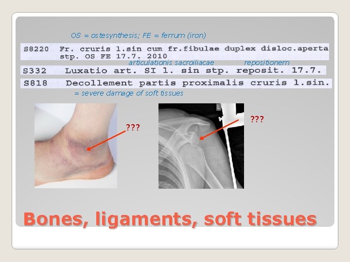 OS = ostesynthesis; FE = ferrum (iron) articulationis sacroiliacae repositionem = severe damage of