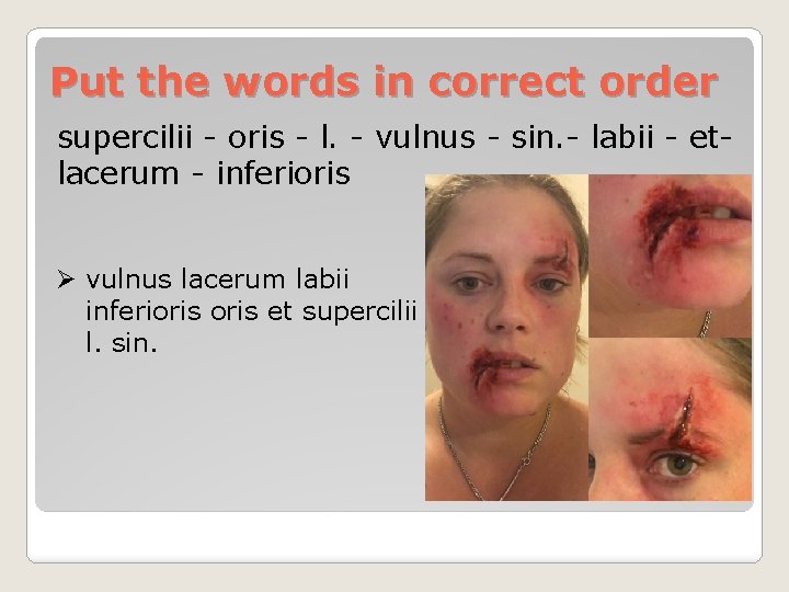 Put the words in correct order supercilii - oris - l. - vulnus -