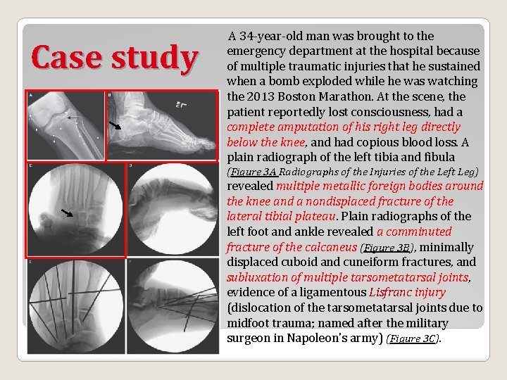 Case study A 34 -year-old man was brought to the emergency department at the