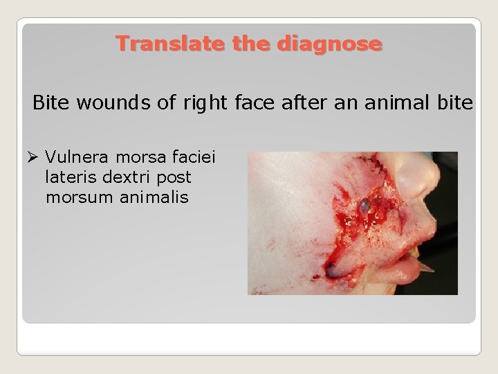 Translate the diagnose Bite wounds of right face after an animal bite Ø Vulnera