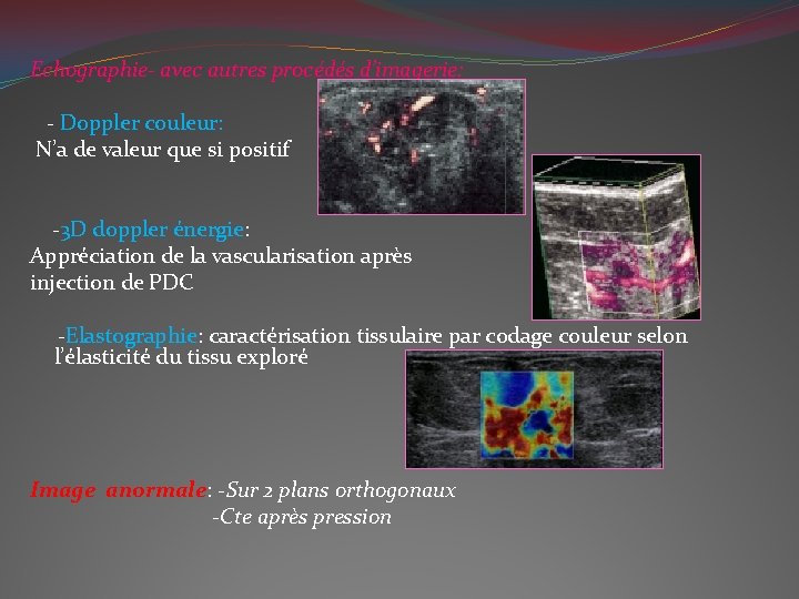 Echographie- avec autres procédés d’imagerie: - Doppler couleur: N’a de valeur que si positif