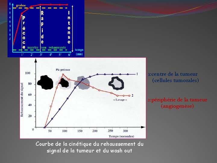 1: centre de la tumeur (cellules tumorales) 2: périphérie de la tumeur (angiogenèse) Courbe