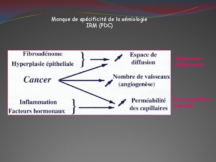 Manque de spécificité de la sémiologie IRM (PDC) Diagnostic différentiel Faux positifs et négatifs
