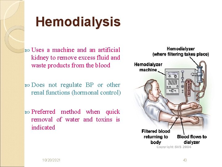 Hemodialysis Uses a machine and an artificial kidney to remove excess fluid and waste